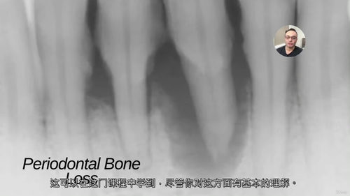 口腔影像诊断视频课