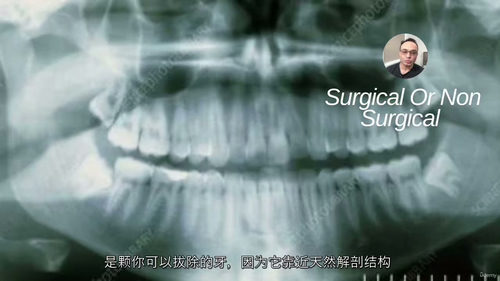 口腔影像诊断视频课