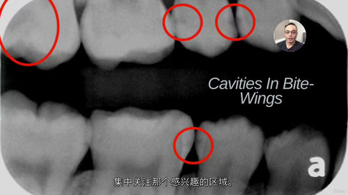口腔影像诊断视频课