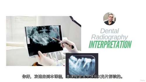 口腔影像诊断视频课