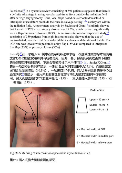 喉癌:基于临床病例的处理方法 罗热里奥·A·德迪维斯, 乔治·佩雷蒂, 伊哈布·汉纳, 克劳迪奥·R·塞尔内亚 (中英对照电子书)