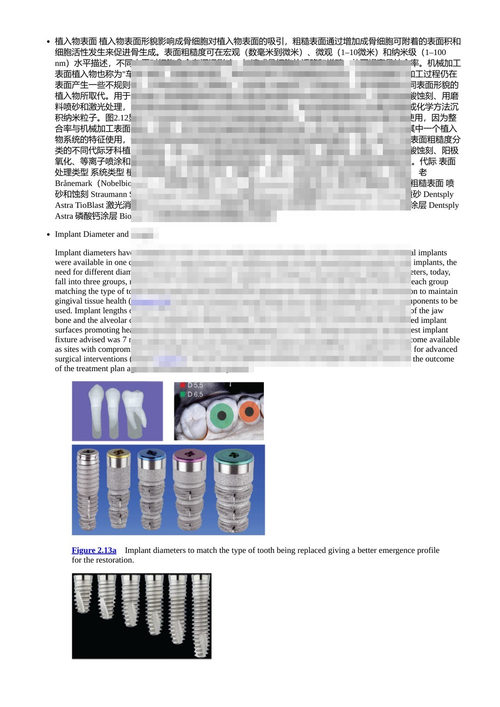 牙科种植体：口腔卫生师与治疗师指南 乌尔皮·达尔巴 （中英对照电子书）
