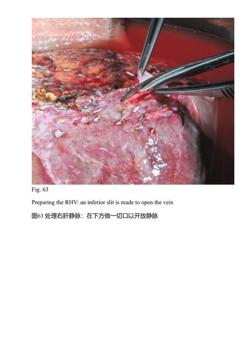腹部器官与组织移植 拉娜·扎克里、尼古拉斯·卡里迪斯、彼得·戈加尔尼恰努 (中英对照电子书)