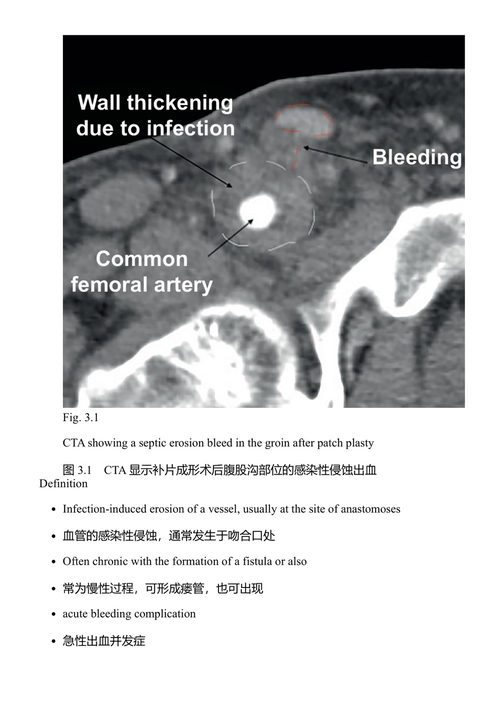 血管外科急症：值班前的充分准备 苏珊娜·雷古斯 (中英对照电子书)