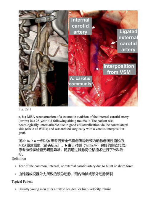 血管外科急症：值班前的充分准备 苏珊娜·雷古斯 (中英对照电子书)
