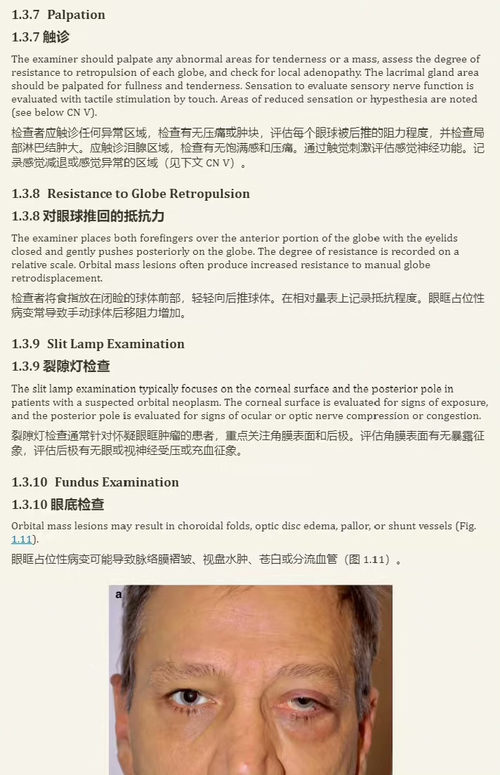 [中英对照] 《临床眼科肿瘤学：眼眶肿瘤》（第四版）（双语对