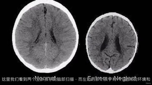 家长神经科学指南：养育优秀孩子的实用课程  (中文字幕英文视