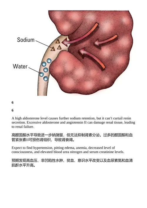 病理生理学轻松图解 Lippincott (中英对照电子书)