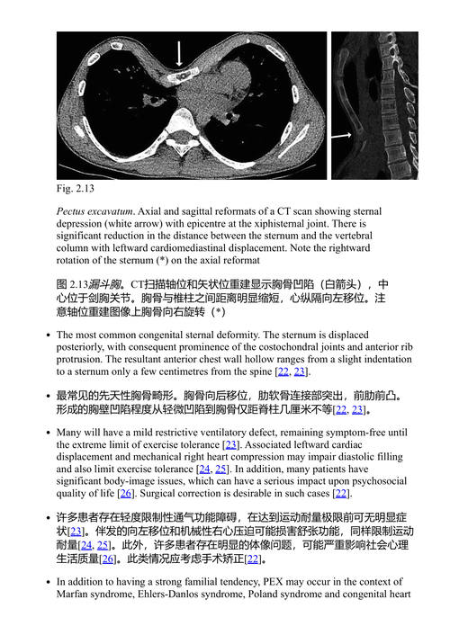 影像解剖变异：临床实践中的应用 (中英对照电子书)