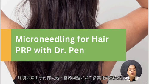 毛发修复专项培训 - PRP联合微针技术（Dr. Pen应用