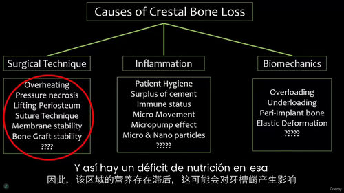 种植体设计对种植体周围健康的重要性 (中文字幕英文视频教程)