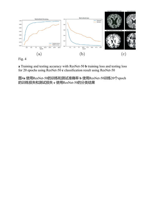 机器学习及其在医疗保健中的应用 米莉·潘特、库苏姆·迪普、阿图利亚·K·纳格尔 (中英对照电子书)