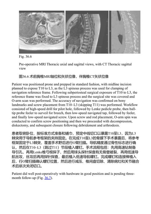腰椎外科：原理与技术 阿利·A·巴杰等 (中英对照电子书)